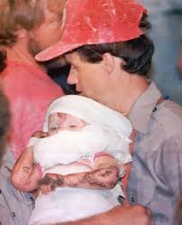 Adopting parents' minimum age, medical and the top 10 adoption requirements to adopt a baby. Jessica Mcclure An 18 Month Old Girl Is Saved After 58 Long Hours Trapped In A Well In 1987 New York Daily News