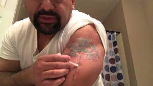 Can a tattoo be removed with a home treatment? How To Remove A Tattoo You Regret Man Of Many