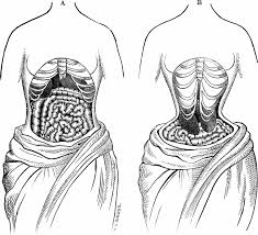Pain in the stomach and lower back can be caused by constipation, stones in the kidney or gallbladder, or a cyst. Here S How Corsets Deformed The Skeletons Of Victorian Women