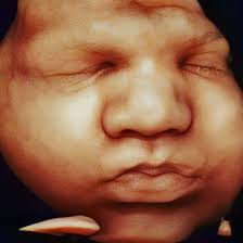 Sneak Peek Ultrasound Studio