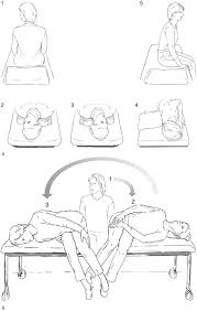 The epley maneuver, however, can dislodge these crystals and remove them from the semicircular canals. Self Treatment Of Benign Paroxysmal Positional Vertigo Neurology