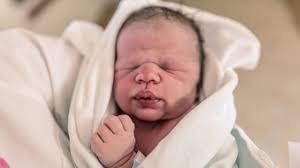 Lakukan lebih kurang 2 minggu, karena setelah itu, umumnya saluran air mata telah terbuka tetap. Ini Alasan Kenapa 7 Bagian Tubuh Bayi Baru Lahir Kadang Terlihat Aneh Dan Menakutkan