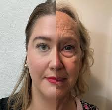 Mother and Daughter: Facial Aging in a Modern Era - Skin Synthesis