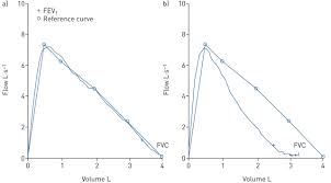 Asthma exacerbation severity can be quantified by comparing a patient's current peak expiratory flow rate (pefr) to their most recent personal best value. Diagnosing Asthma In Children Or Adolescents Young Adults It Is Time For A Change How Timing Is Everything Also In Clinical Practice European Respiratory Society