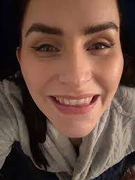 십대때 페이스 피어싱 하지 말라고 했던 기억이 난다. 우리가 제거하기로 결심했기 때문에 상처가 남았다. 내 얼굴에 작은 점 하나가  어른의 인생에서 가장 큰 걱정인 것처럼...