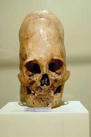 Untitled Ancient Aliens Ancient Mysteries Alien Skull The elongated skulls were sent to different museums, and. untitled ancient aliens ancient