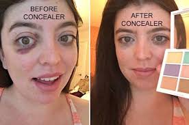 31 Holy Grail Beauty Products That People Actually Swear By Makeup To Cover Bruises Color Correcting Concealer How To Cover Bruises