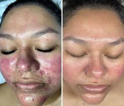 Olivia Dueñas Alcalá (@iriaskinoasis) • Instagram photos and videos