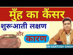 What does mouth cancer look like? à¤® à¤¹ à¤• à¤• à¤¸à¤° à¤• à¤¸ à¤¹ à¤¤ à¤¹ Mouth Cancer In Hindi Muh Ka Cancer Mouth Cancer Symptoms In Hindi Youtube