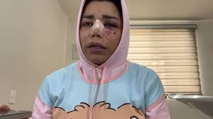 Paola Suárez, tras ser golpeada, vive conmovedor momento con fan de 9 años  que le expresa su preocupación: video | Entretenimiento Cultura Pop |  Univision