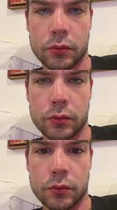 Patrick Calvo Sem Bone Fotos