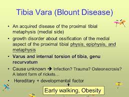 Tibia Vara Blount S Disease Max Superspecialty Ortho Clinic