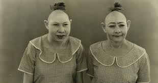 В нее влюблен карлик ганс, которому она предпочла силача геркулеса. Gorgeous Cast Portraits From Tod Browning S Freaks 1932 Dangerous Minds