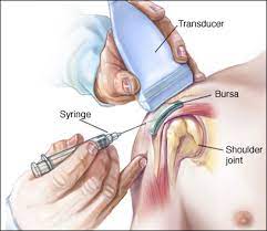 Joint Pain Varicose Veins Vascular Surgeon Stroke Dvt Leg Gangrene Cancer