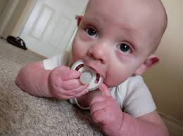 I worry that my sons plates have fuzed. Waiting