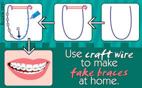 Want To Wear Fake Braces To Fool Your Friends Or To Look Geek Chic For A Party Check Out How To Make Fake Braces Tha Fake Braces Diy Braces How To