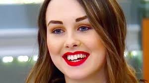 Woman with alopecia takes off wig to unveil bald head to shocked date