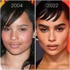 Qui sont ces stars qui auraient succombé à la bichectomie ?