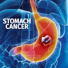 This cancer is also called gastric cancer. Medical Tourisum India Travcure
