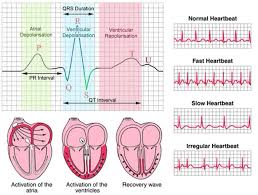 Ecg Explained Medical School Studying Cardiology Heart Block Poem