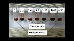 How the test is performed. How To Determine Antibody Titer Youtube