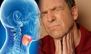 All of the passageway between your tongue and your esophagus can be considered the throat. Throat Cancer Symptoms And Signs Are You At Risk Watch Out For A Sore Throat Express Co Uk