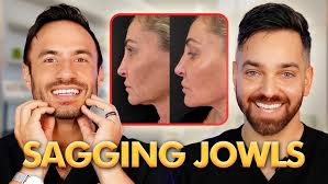 ACID TONERS PART ONE