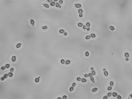 Image result for Buchnera candida