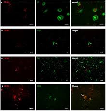 Double b distributing21, ingleside, texas. Phenotypic Profile Of Alternative Activation Marker Cd163 Is Different In Alzheimer S And Parkinson S Disease Acta Neuropathologica Communications Full Text