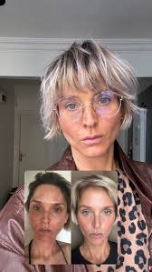 It's not a „treatment“—it's a skincare routine, but smarter! We all know  that harsh treatments don't work when it comes to reversing melasma. What  actually makes a difference is a consistent routine!