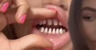Make whitening your teeth at home easy. The Tiktok Veneers Trend Is Dangerous