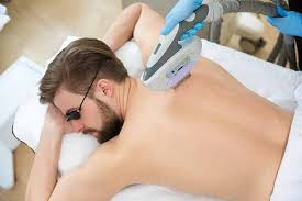 Laser hair removal is performed by targeting the hair follicle with an intense pulsating beam of light to destroy it. Rockville Dermatologist Offers Safe Laser Hair Removal Washington Dermatology Center