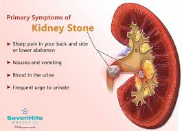 Often There Are No Symptoms Of A Kidney Stone Until It Starts To Move And Block The Flow Of Urine Kidney Ston Kidney Stones Symptoms Kidney Stones Symptoms