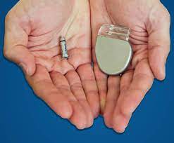 Το κόστος κατασκευής της πολυκατοικίας ήταν υψηλό. Bhmatodoths Xwris Hlektrodia Leadless Pacemaker Mikrotero Mege8os Megalyterh Eyeli3ia