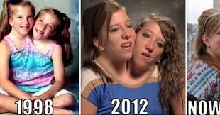 Their mother, patty, was a nurse, while their father, mike, worked as a landscaper and carpenter. Abby And Brittany Hensel Restroom Real Answers To Questions You Ve Always Had About Conjoined Twins The Two Became Household Names After They Let The Media Into Their Unique Lives For
