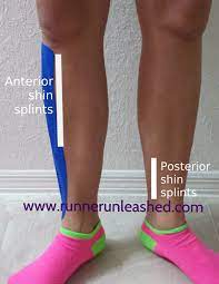 Anterior And Posterior Shin Splints Causes Symptoms And Advice And Stretches To Help Treat Or Preven Anterior Shin Splints Shin Splints Shin Splint Exercises