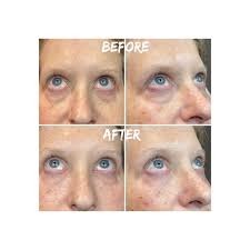 Raleigh Skin Care Clinic