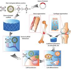 Je vous déconseille d'acheter peugeot c'est une catastrophe dirigez vous vers de l'allemend j'ai eu beaucoup de souci avec ma 308 et je me suis dis. Controlled Non Viral Gene Delivery In Cartilage And Bone Repair Current Strategies And Future Directions Gonzalez Fernandez 2018 Advanced Therapeutics Wiley Online Library
