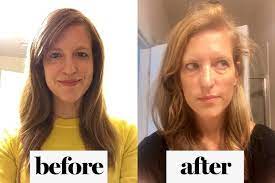 Having A Baby Gave Me A Receding Hairline Postpartum Hair Loss Receeding Hairline Hair Loss Causes