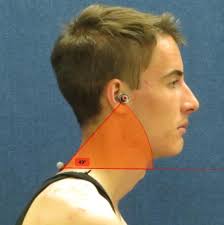 The Effects of Postural Education or Corrective Exercise