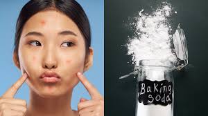 Caranya ialah panaskan air dalam kuali atau periuk hingga mendidih dan masukkan soda bikarbonat. Soda Bikarbonat Untuk Muka