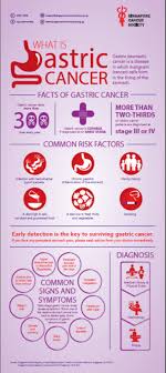 Symptoms of indigestion, such as burping a lot. Gastric Cancer Campaign