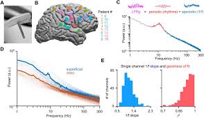 The timescale and magnitude of 1/f aperiodic activity decrease with  cortical depth in humans, macaques, and mice