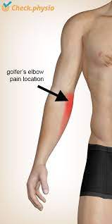 Tennis and golfers elbow involves more than just inflammation, there is a rather significant break down of tendon tissues. Golfer S Elbow Physio Check