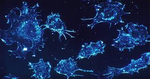 lung cancer in people who don&#x27;t smoke can be caused by exposure to radon, secondhand smoke, air pollution, or other factors. Protein Could Lead To A Lung Cancer Or Mesothelioma Treatment