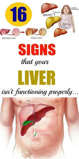 When cancer starts in the liver, it is called liver cancer. 16 Signs That Your Liver Isn T Functioning Properly Greatest Today Healthy Diet Tips Health Health And Wellbeing