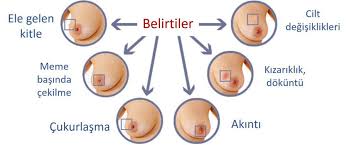 Lenfoid doku (boyunda, ciğerlerin arasındaki boşlukta, kasıklarda. Koltuk Alti Lenf Bezi Kanseri Belirtileri Bellona Koltuk Takimi