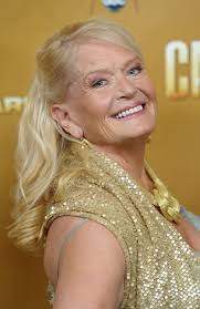 Country Star Lynn Anderson Has Died at Age 67