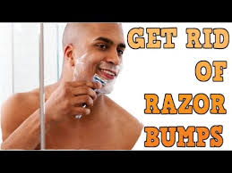 10 Home Remedies To Get Rid Of Razor Bump How To Get Rid Of Razor Bumps Youtube