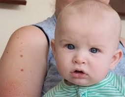 One-punch victim wakes up after life support is turned off in Melbourne.